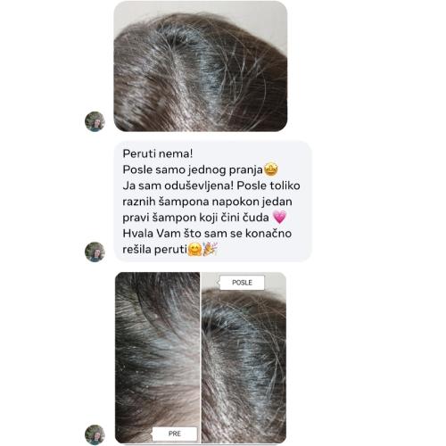 novi Å¡Å¡ampÅ¾