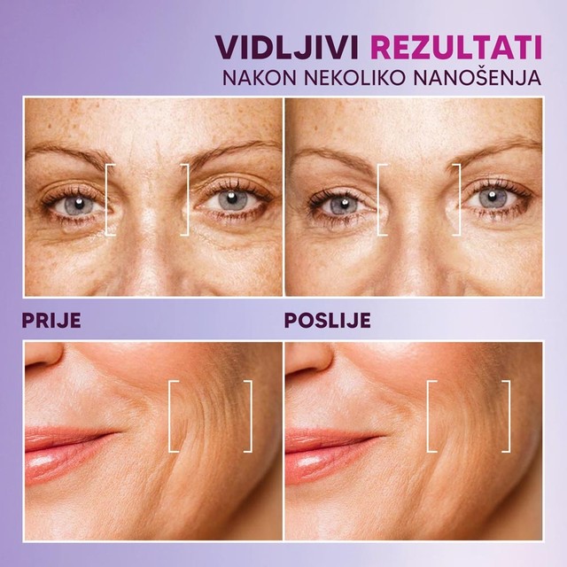 serum sa biopepidima PRIJE-POSLIJE-- slajd 5 bih
